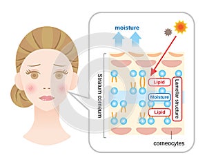 Structure of stratum corneum and lamellar structure, which play the protective role for skin barrier functions. beauty and skindry photo