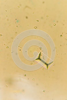 Struvites at the microscope