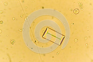 Struvites at the microscope