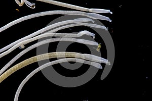 The study of Acanthocephala is a phylum of parasitic worms known as acanthocephalans, thorny-headed worms.
