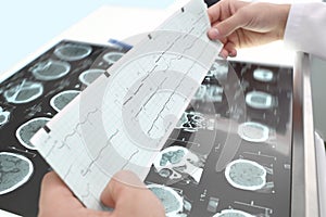 Study of ECG and tomography