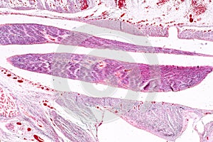 Study Histology of human, tissue bone under the microscopic.