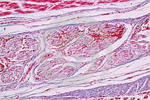 Study Histology of human, tissue bone under the microscopic.