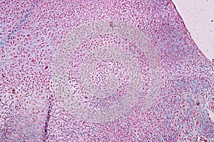 Study Histology of human, tissue bone under the microscopic.