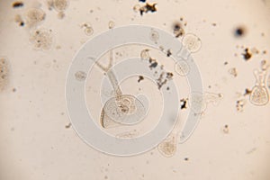 Transversotrema patiallensis parasite under the microscopic in laboratory. photo
