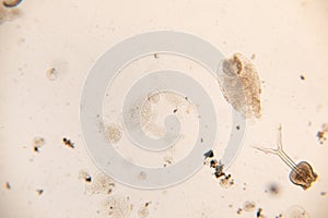 Transversotrema patiallensis parasite under the microscopic in laboratory. photo