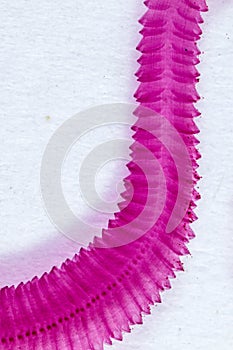 Study of Parasitic and Anatomical pathology in laboratory. photo