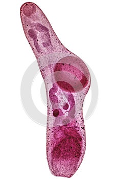 Study of Parasitic and Anatomical pathology in laboratory. photo
