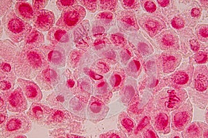 Root tip of Onion and Mitosis cell in the Root tip of Onion under a microscope.