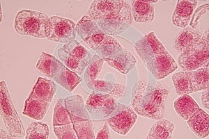 Root tip of Onion and Mitosis cell in the Root tip of Onion under a microscope.