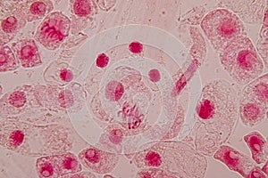 Root tip of Onion and Mitosis cell in the Root tip of Onion under a microscope.