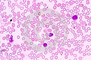 white blood cells are the cells of the immune system under the microscope in laboratories.