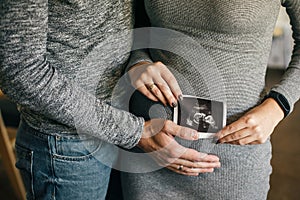 Stylish pregnant couple holding ultrasound scan of baby on baby bump. Healthy young parents holding in hands on belly photo of