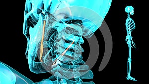 Stylohyoid - 3D model