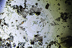 Stylonichia mytilus and microalgae