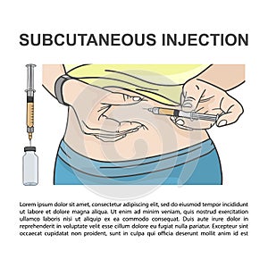 SUBCUTANEOUS INJECTION In Stomach Medical Vector Illustration