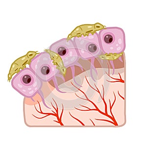 Subcutaneous tick. Skin parasite. Beetles on human epidermis.