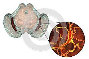 Substantia nigra in Parkinson`s disease