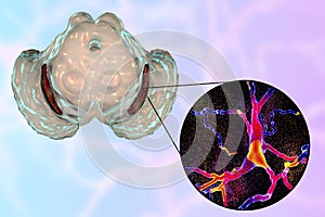 Substantia nigra in Parkinson`s disease