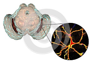 Substantia nigra in Parkinson`s disease