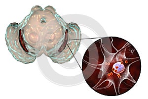 Substantia nigra in Parkinson& x27;s disease