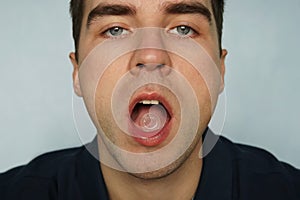 Sucking pill for sore throat in mouth. A young man sick with SARS or the flu or colds Peppermint for fresh breath, close - up of o