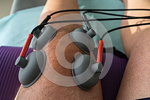 Suction cups applied to a knee in physiotherapy