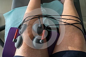 Suction cups applied to a knee in physiotherapy