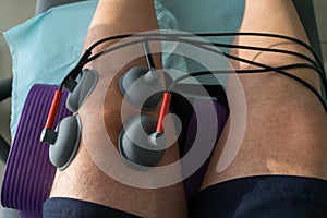 Suction cups applied to a knee in physiotherapy
