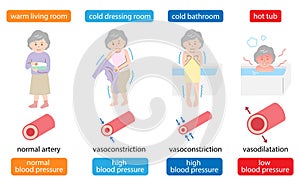 Sudden change in temperature in the bathroom can be harmful to the body blood pressure. Vasoconstriction and
