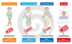 Sudden and extreme change in bath can be harmful to the body blood pressure. Vasoconstriction and  vasodilatation illustration. photo