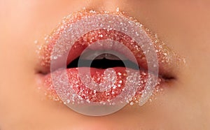 Sugar lips. Closeup lip with sugar. Beauty treatments. Lipscare cosmetics.