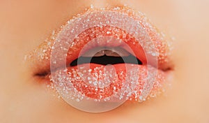 Sugar lips. Closeup lip with sugar. Beauty treatments. Lipscare cosmetics.