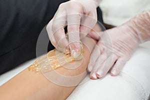 Sugar paste hair removal procedure - shugaring. Cosmetologist applies sugar paste to the hand of a young woman