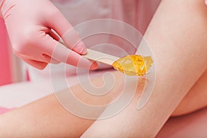 Sugaring. Young woman gets the procedure for hair removal liquid sugar. Beautician depilating young woman`s legs with liquid suga