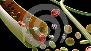 Sulfhemoglobinemia is characterized by abnormally high levels of sulfhemoglobin