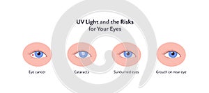 Summer uv sunscreen protection and eye diseave concept. Vector flat healthcare iillustration. Various eye disease symbol. Cancer,