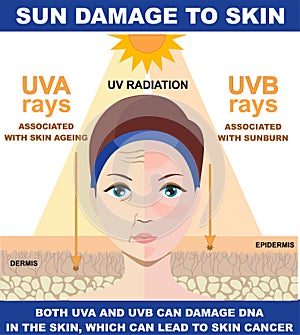 Sun damage to skin.The difference of radiation 2 types in sunlight which is harmful to the skin. Infographic of
