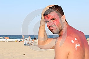 Sunburned man with lots of pain