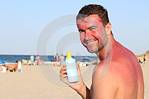 Sunburned man using tanning accelerator lotion