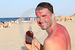 Sunburned man using tanning accelerator lotion photo