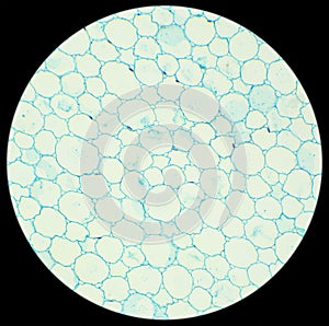 Sunflower stalk cross-section under the microscope, (Helianthus