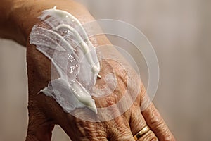 Sunscreen spread on an elderly lady& x27;s hand