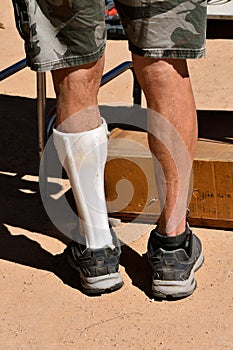 Supportive plastic leg brace worn by a man