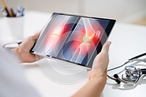 Surgeon Doctor Looking At Knee Xray Bone Scan