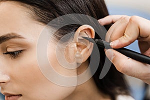 Surgeon draw marking on ear before otoplasty cosmetic surgery. Otoplasty markup before ear surgery. Otoplasty mark-up photo