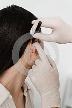 Surgeon draw marking on ear before otoplasty cosmetic surgery. Otoplasty markup before ear surgery. Otoplasty mark-up