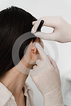 Surgeon draw marking on ear before otoplasty cosmetic surgery. Otoplasty markup before ear surgery. Otoplasty mark-up