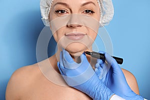 Surgeon with marker preparing woman for operation against background. Double chin removal