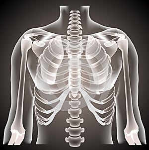 Surgeon radiologist medical examaning lung torso